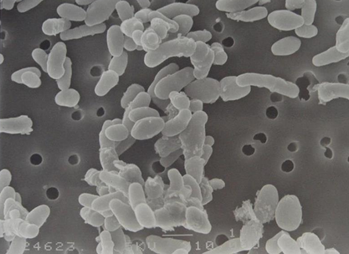 Bifidobacterium breve M-16V Bifidobacterium breve M-16V